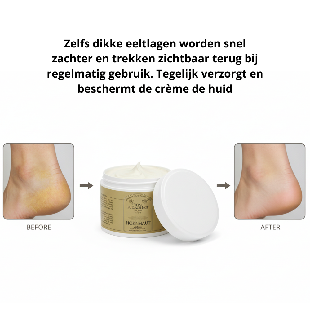 Eeltbalsem 500ml Huidverzorging Traditionele Pullach HOF XL